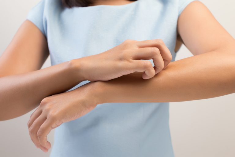 Need Help Paying for Your Eczema Treatment Prescription?