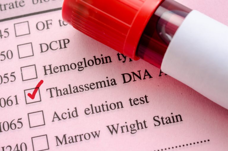 Treatment, Symptoms, and Signs of Sickle Cell Anemia