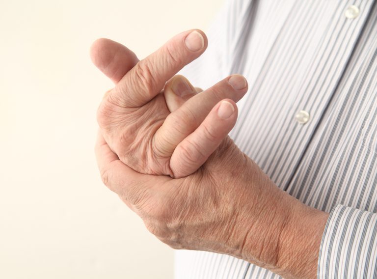 Exploring the Treatments and Signs of Psoriatic Arthritis