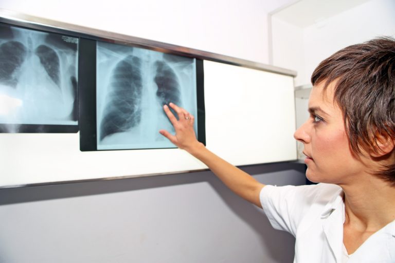 Need Help Paying for Medications to Treat Pulmonary Hypertension?